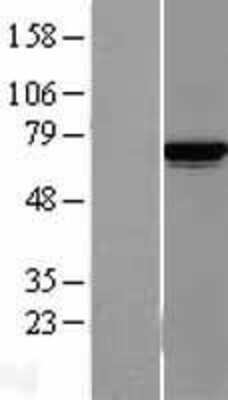 Western Blot: Lysyl tRNA synthetase Overexpression Lysate [NBL1-12123]