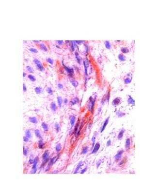 Immunohistochemistry-Paraffin: M-CSF Antibody [NBP1-59425]