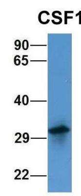 Western Blot: M-CSF Antibody [NBP1-59425]