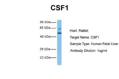 Western Blot: M-CSF Antibody [NBP1-59425]