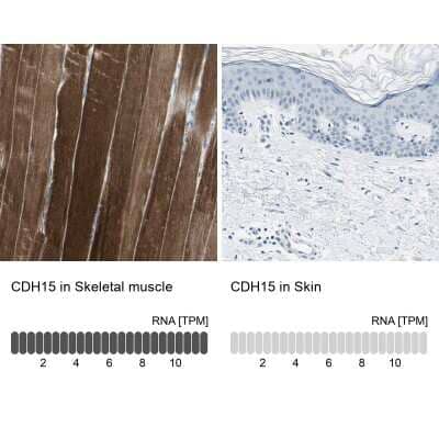 Immunohistochemistry-Paraffin: M-Cadherin/Cadherin-15 Antibody [NBP1-88101]