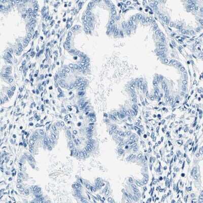Immunohistochemistry-Paraffin: M-Cadherin/Cadherin-15 Antibody [NBP1-88101]
