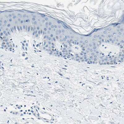 Immunohistochemistry-Paraffin: M-Cadherin/Cadherin-15 Antibody [NBP1-88101]