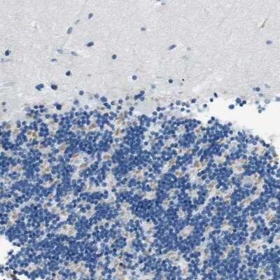 Immunohistochemistry-Paraffin: M-Cadherin/Cadherin-15 Antibody [NBP1-88101]