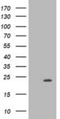 Western Blot: M-Ras/R-Ras3 Antibody (OTI3C4)Azide and BSA Free [NBP2-72776]