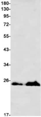 Western Blot: M-Ras/R-Ras3 Antibody (S07-2A5) [NBP3-19680]