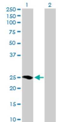 Western Blot: M-Ras/R-Ras3 Antibody [H00022808-B01P]