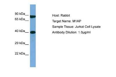 Western Blot: M1AP Antibody [NBP2-87102]