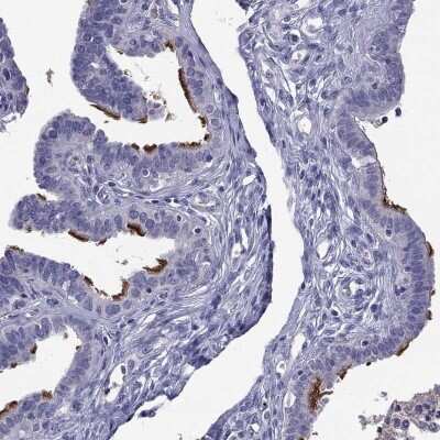Immunohistochemistry-Paraffin: MAATS1 Antibody [NBP3-17106]