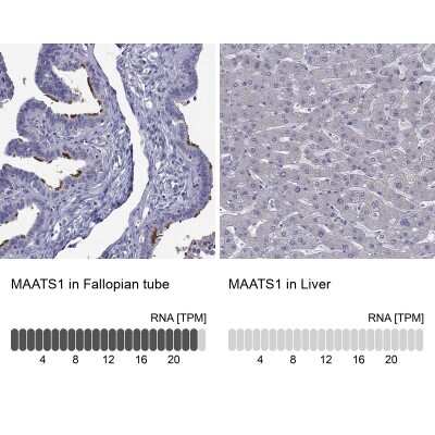 Immunohistochemistry-Paraffin: MAATS1 Antibody [NBP3-17106]