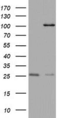 Western Blot: MAATS1 Antibody (OTI6G1)Azide and BSA Free [NBP2-72309]