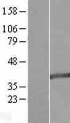Western Blot: MAB21L2 Overexpression Lysate [NBL1-12783]