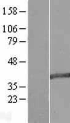 Western Blot: MAB21L2 Overexpression Lysate [NBL1-12783]