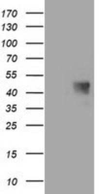 Western Blot: MAB21L3 Antibody (OTI1F6)Azide and BSA Free [NBP2-72563]