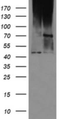 Western Blot: MAB21L3 Antibody (OTI2A3)Azide and BSA Free [NBP2-72562]