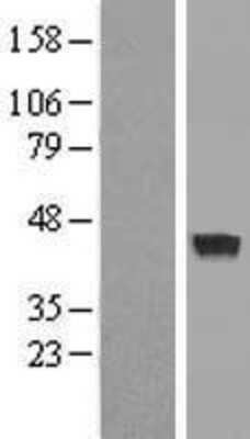 Western Blot: MAB21L3 Overexpression Lysate [NBP2-05396]