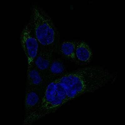 Immunocytochemistry/ Immunofluorescence: MACC1 Antibody (CL0856) [NBP2-52955]