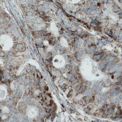 Immunohistochemistry: MACC1 Antibody (CL0856) [NBP2-52955]