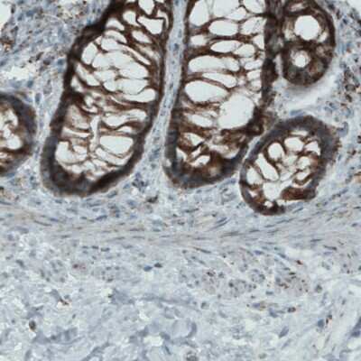 Immunohistochemistry-Paraffin: MACC1 Antibody (CL0856) [NBP2-52955]