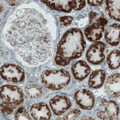 Immunohistochemistry-Paraffin: MACC1 Antibody (CL0856) [NBP2-52955]