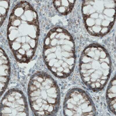 Immunohistochemistry-Paraffin: MACC1 Antibody (CL0856) [NBP2-52955]