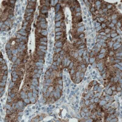 Immunohistochemistry-Paraffin: MACC1 Antibody (CL0856) [NBP2-52955]