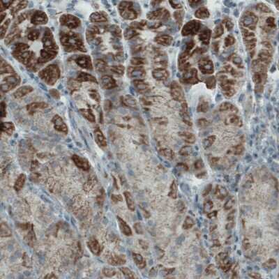 Immunohistochemistry-Paraffin: MACC1 Antibody (CL0856) [NBP2-52955]