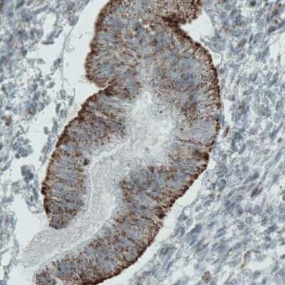 Immunohistochemistry-Paraffin: MACC1 Antibody (CL0856) [NBP2-52955]