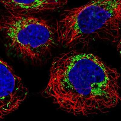 Immunocytochemistry/ Immunofluorescence: MACC1 Antibody [NBP1-89353]