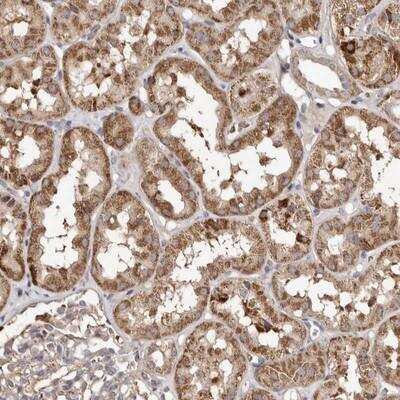 Immunohistochemistry: MACC1 Antibody [NBP1-89353]