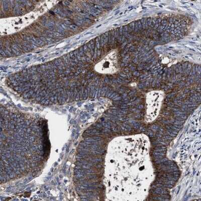 Immunohistochemistry-Paraffin: MACC1 Antibody [NBP1-89352]