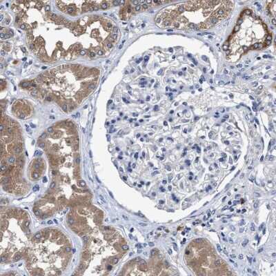 Immunohistochemistry-Paraffin: MACC1 Antibody [NBP1-89352]