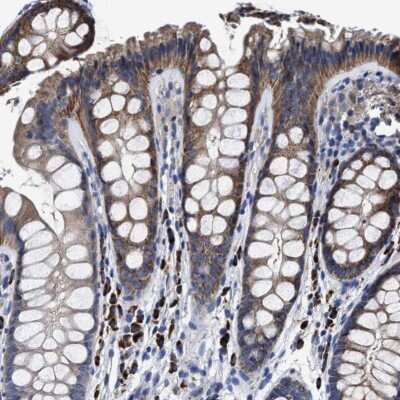 Immunohistochemistry-Paraffin: MACC1 Antibody [NBP1-89352]