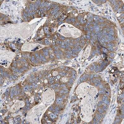 Immunohistochemistry-Paraffin: MACC1 Antibody [NBP1-89352]