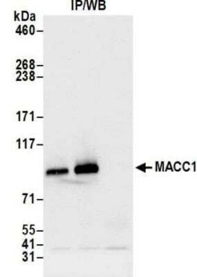 Immunoprecipitation: MACC1 Antibody (BLR135H) [NBP3-14716]