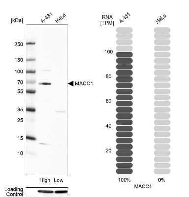 Western Blot: MACC1 Antibody [NBP1-89351]