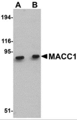 Western Blot: MACC1 AntibodyBSA Free [NBP2-82006]