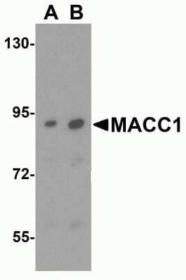 Western Blot: MACC1 AntibodyBSA Free [NBP2-82006]