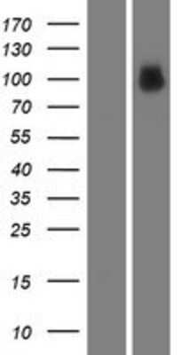 Western Blot: MACC1 Overexpression Lysate [NBP2-04803]