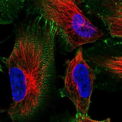 Immunocytochemistry/ Immunofluorescence: MACF1 Antibody [NBP2-57343]