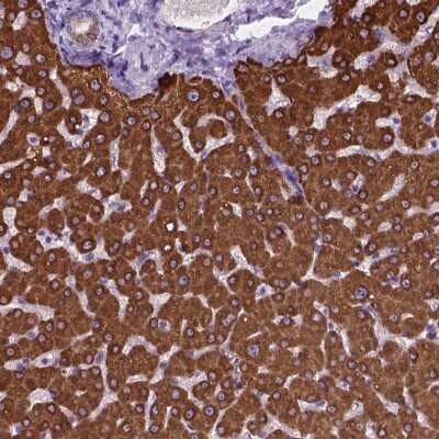 Immunohistochemistry: MACF1 Antibody [NBP2-49542]