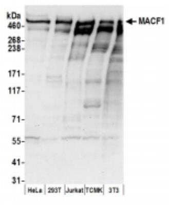 Western Blot: MACF1 Antibody [NBP2-36528]