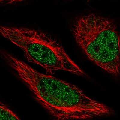 Immunocytochemistry/ Immunofluorescence: MACROD1 Antibody [NBP2-58835]