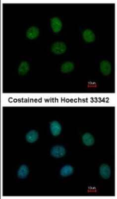 Immunocytochemistry/ Immunofluorescence: MAD1L1/MAD1 Antibody [NBP2-17198]