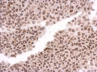 Immunohistochemistry-Paraffin: MAD1L1/MAD1 Antibody [NBP2-17198]