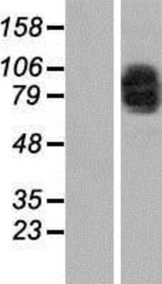 Western Blot: MAD1L1/MAD1 Overexpression Lysate [NBP2-11234]