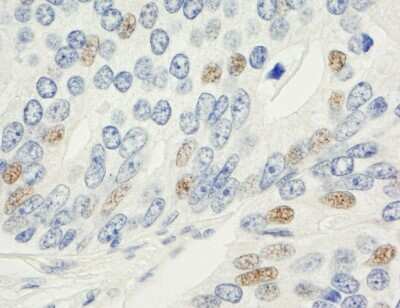 Immunohistochemistry-Paraffin: MAD1L1/MAD1 Antibody [NB100-569]