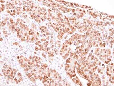 Immunohistochemistry-Paraffin: MAD1L1/MAD1 Antibody [NBP1-32775]