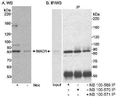 Immunoprecipitation: MAD1L1/MAD1 Antibody [NB100-569]