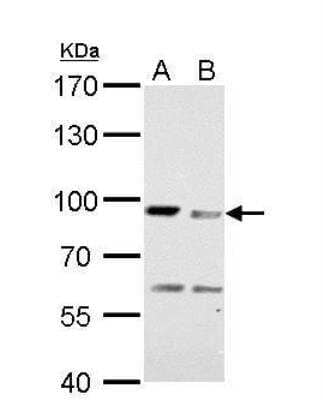 Western Blot: MAD1L1/MAD1 Antibody [NBP1-32775]